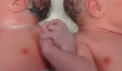 Twins tenir la main Moments après la naissance (Photo)