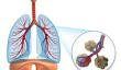 Air dans le corps - ce que vous devez savoir sur la respiration