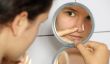 Qu'est-ce que vous pouvez faire contre les grands pores sur le visage