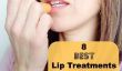 8 meilleurs traitements pour les lèvres Pour Serious Protection contre le froid