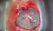 15 faits étonnants sur le placenta, cordon ombilical et le sac amniotique