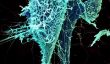 Ebola Virus & épidémie en Afrique de l'Ouest: mortel, maladie contagieuse se propage à Libera, Sierro Leone;  80 Décès So Far