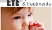 Le redouté Pink Eye: causes, symptômes et traitements