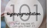Hyperpigmentation 101: Quels sont ces taches et comment les traiter
