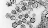 Top 10 des virus les plus dangereux sur Terre