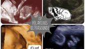 20 Funniest ultrasons Photos
