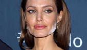 Nicole Kidman: visage Botox à Cannes