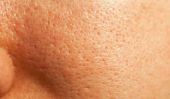 Grand-pores peau du visage - soins de la peau