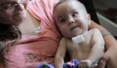 Médecins vie de Sauvez les bébés avec le dispositif 3D