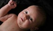 Neugeborenenakne - comment traiter-vous?
