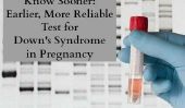 Nouveau test détermine le syndrome de Down-de risque du bébé pendant la grossesse