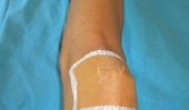 Médecins découvrir de nouveaux ligaments du genou