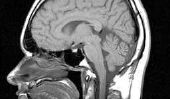 Marijuana Avantages et inconvénients de recherche juridiques: Rapport sur les résultats des chercheurs anomalie cérébrale dans le Journal of Neuroscience