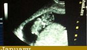 2011 - Grossesse, naissance et bébé
