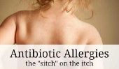 Antibiotique Allergies: Le Sitch sur la Itch