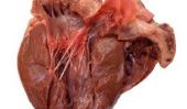 Valves auriculo-ventriculaires et rabats de poche - différence facilement expliquées