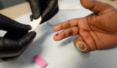Nations Unies Says épidémie de VIH / sida pourrait venir à sa fin en 2030