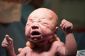 CDC Pousser circoncision sur Tous les bébés garçons ?!
