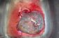 15 faits étonnants sur le placenta, cordon ombilical et le sac amniotique