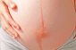 10 façons de grossesse change votre peau
