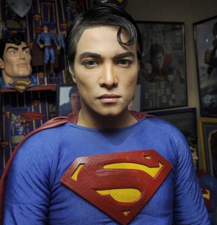 Superman Fan subit une intervention chirurgicale esthétique pour ressembler au Superhero