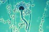 Top 10 des bactéries les plus dangereuses sur terre