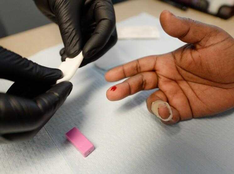Nations Unies Says épidémie de VIH / sida pourrait venir à sa fin en 2030